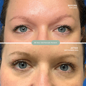38 Year Old Female Patient