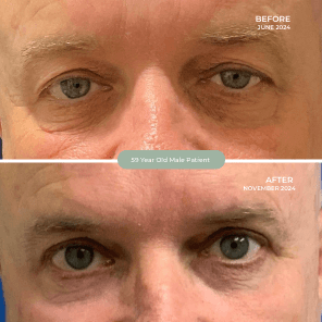 53 Year Old Male Patient